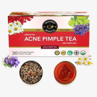 Teacurry Acne Tea (1 Month Pack 