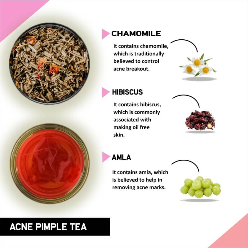 Teacurry Acne Tea (1 Month Pack | 30 Tea Bags) - Helps In Pimples, Cysts, Pustules & Nodules