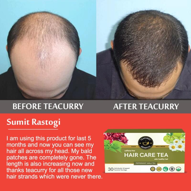 Teacurry Hair Care Tea (1 Month Pack | 30 Tea Bags) - Helps With Hair Growth, Shine, Repair & Strength